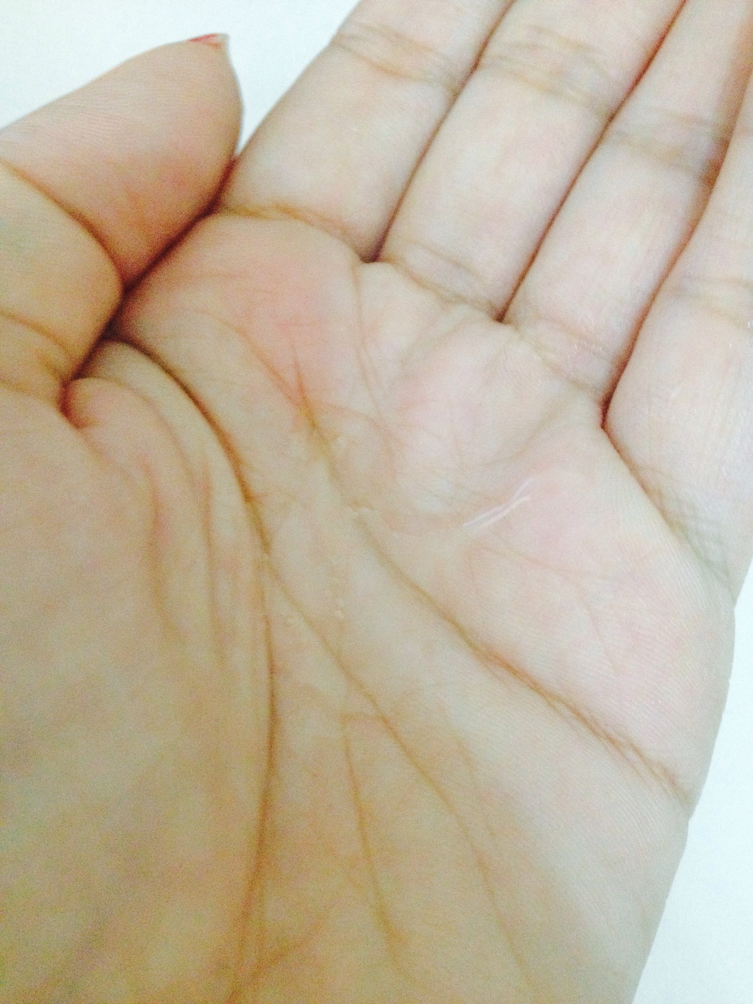 Actine sabonete líquido facial rosto pele acneica oleosa