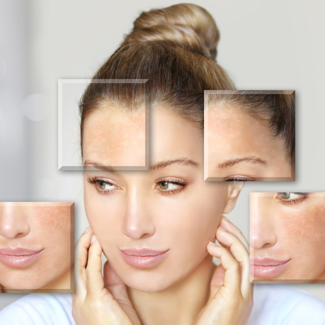 Microbioma desequilibrado